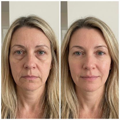 elova | Cepillo de masaje linfático facial